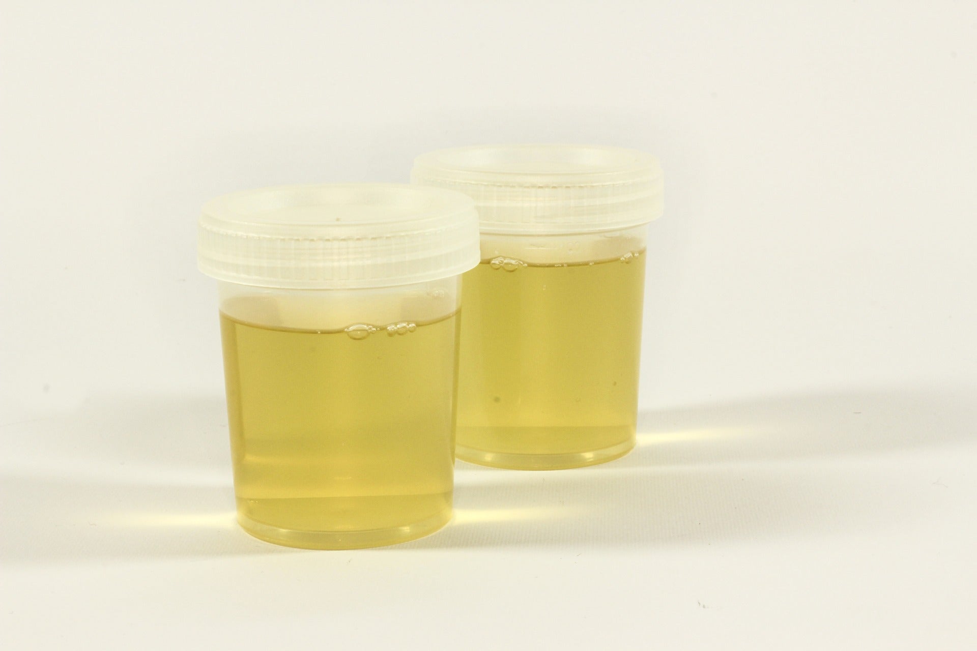 8 Reasons For Urinary Leaks and 8 Ways to Prevent Them